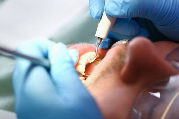Best Emergency Gum Pain Relief  in Lost Hills, CA